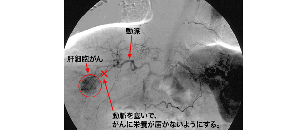 �̓����ǐ��p�@�ʐ^1