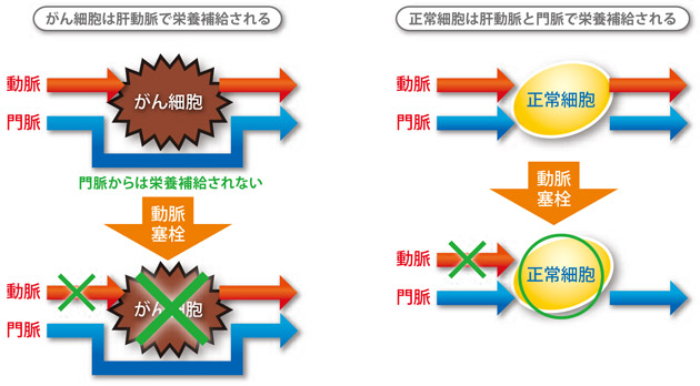 �̓����ǐ��p�@�}1